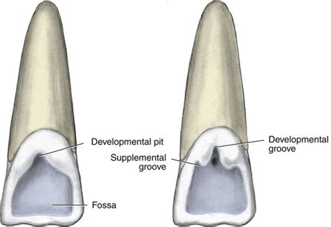 16. Permanent Anterior Teeth | Pocket Dentistry