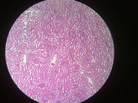 Kidney Histology – howMed