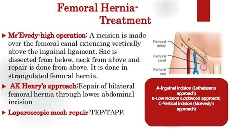 Femoral hernia - Groin swellings