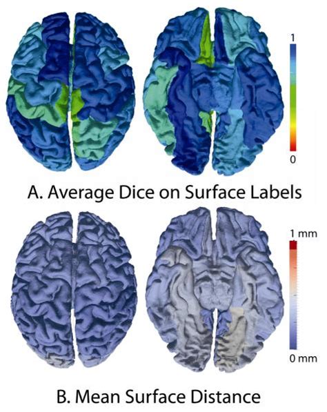 System for Integrated Neuroimaging Analysis and Processing of Structure. | Medical-image ...