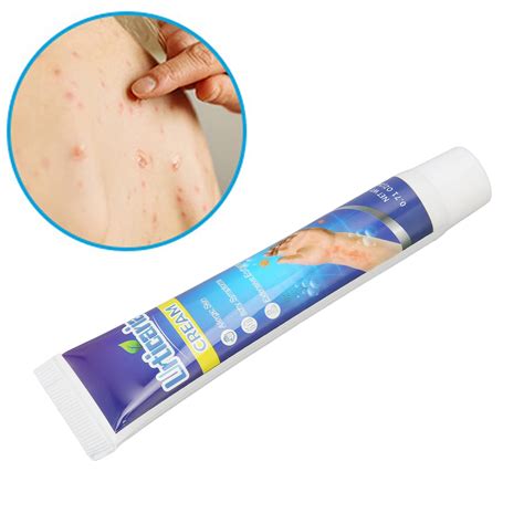 Buy Itching Cream Pruritus Ointment for Dry Skin Adjunctive Treatment Microbiome Maintaining ...