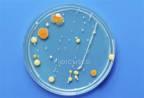 Microbiological culture growing in Petri dish. — top view, equipment - Stock Photo | #194415694