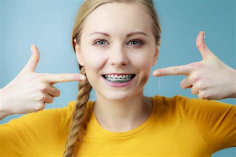 Blue Braces: How To Pick the Right Colors for Your Braces - Blue Ridge Orthodontics