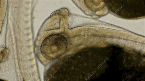 Fish embryo, microscopy - Stock Video Clip - K011/0091 - Science Photo Library