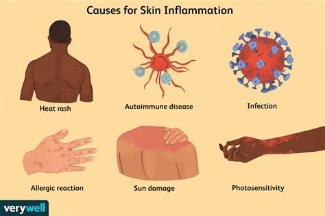 Skin Inflammation: Causes and Treatments