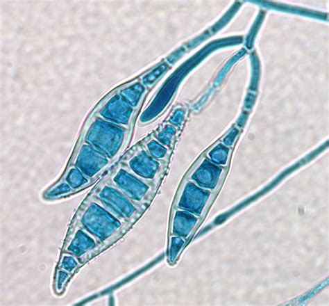 MicroCulture — Fungal macroconidia