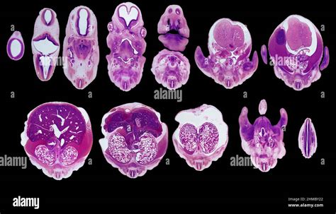 Pig Embryo development, LM Stock Photo - Alamy