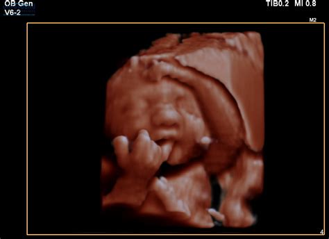 3D Scan at 29 Weeks - Look at those hands! - Ultrasound Scan Dublin - Ultrasound Ireland ...