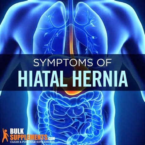 Hiatal Hernia: Symptoms, Causes & Treatment