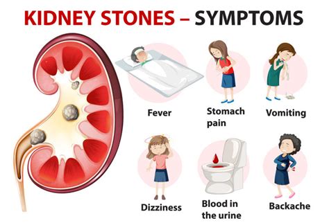 Kidney Stone Pain Symptoms