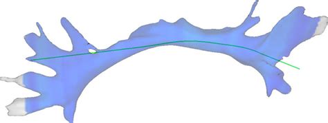 Improvement of the centerline of the cingulum. | Download Scientific Diagram