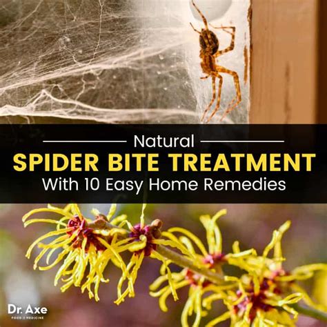 Spider Bite Treatment: 10 Natural Home Remedies - Dr. Axe