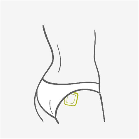 Contraceptive Patch - Hormonal Method