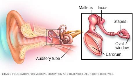 Ear Wax Removal | Beltone Hearing Center