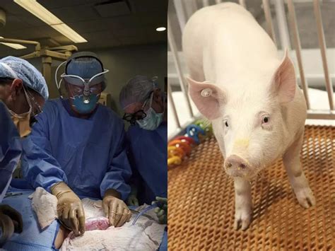 Doctors successfully transplant pig's kidney into human being