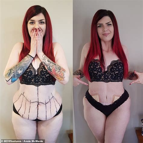 Incredible transformation of woman, 25, who had excess skin removed | Daily Mail Online