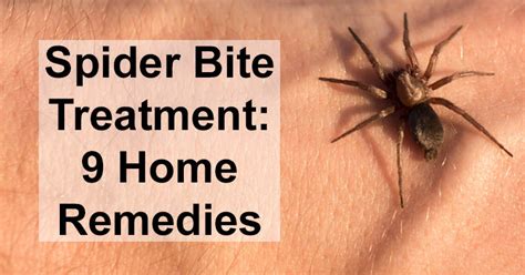 Spider Bite Treatment: 9 Home Remedies - DavidWolfe.com