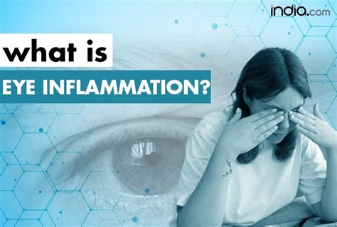 Eye Inflammation: Symptoms, Causes And Treatment of Uveitis