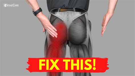 The QUICKEST Way to Get Sciatic Leg Pain Relief - YouTube