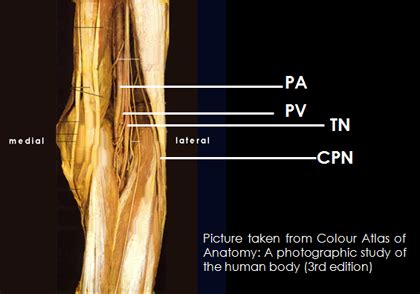 It is most commonly used in combination with a popliteal sciatic or lower anterior sciatic block ...