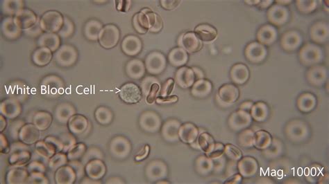 Red Blood Cells Under Microscope Labeled