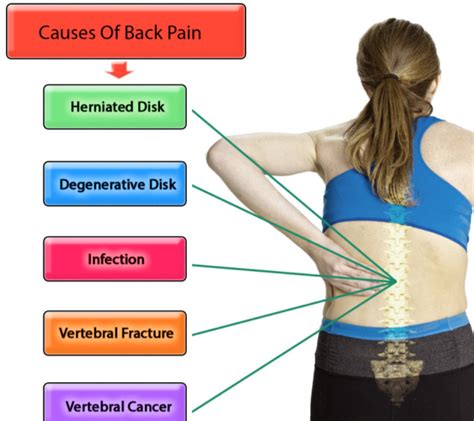 Causes of Back Pain: What Causes Back Pain? - Health Normal