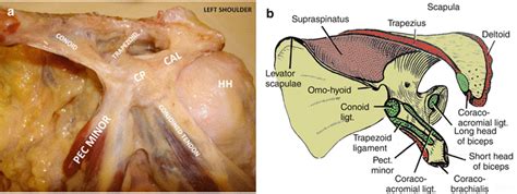 Coracoid Process | Musculoskeletal Key