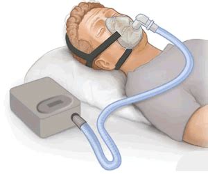 I can’t tolerate a CPAP machine – What alternatives are available? | Snoring Mouthpiece Guide