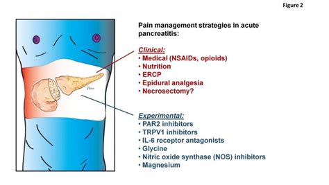 Pain management acute pancreatitis | Epomedicine