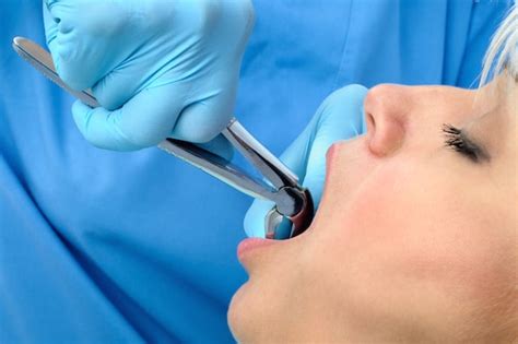 Recovery Tips for Tooth Extraction | American Cosmetic Dentistry