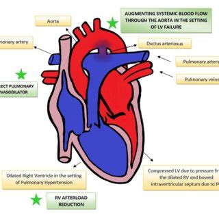 | Effect of PGE1 in PH-RV afterload reduction, direct pulmonary... | Download Scientific Diagram