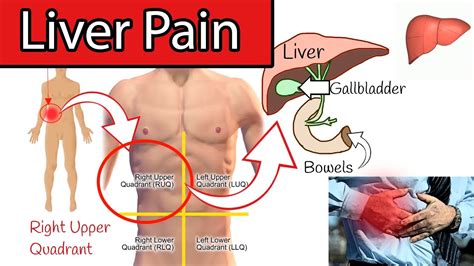 Liver Pain Location Diagram