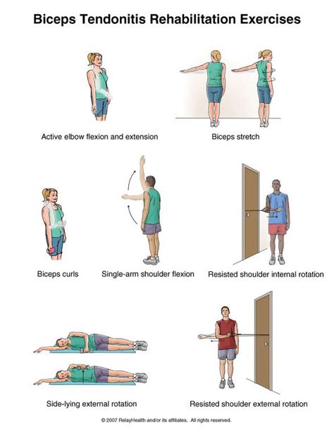 이두박근 건염(Biceps Tendonitis) 재활운동 | Bicep tendonitis, Bicep tendonitis exercises, Physical therapy ...