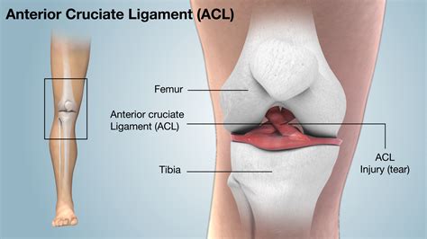 Acl - amelatracking