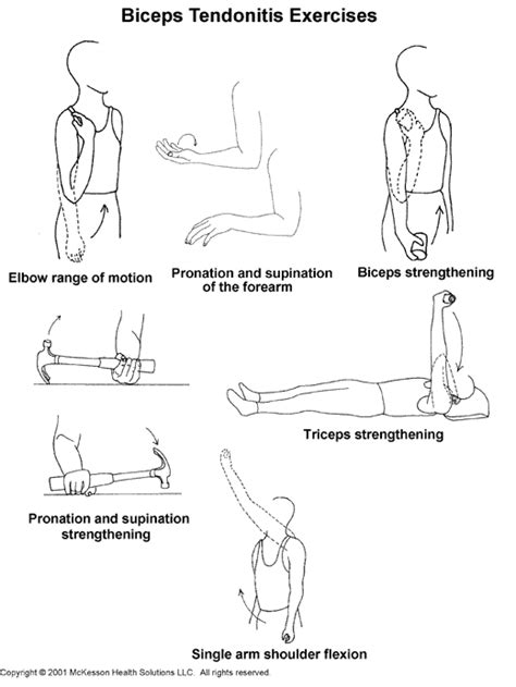 Sports Medicine Advisor 2003.1: Biceps Tendonitis Exercises: Illustration