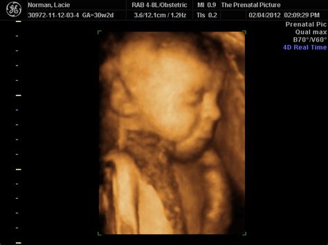 The Norman Family Blog....: 4D Ultrasound (30 Weeks & 2 Day)