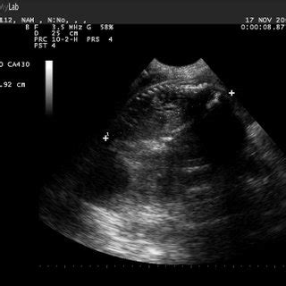 Graph of fetus growth in pregnant pig by ultrasound scanning. | Download Scientific Diagram