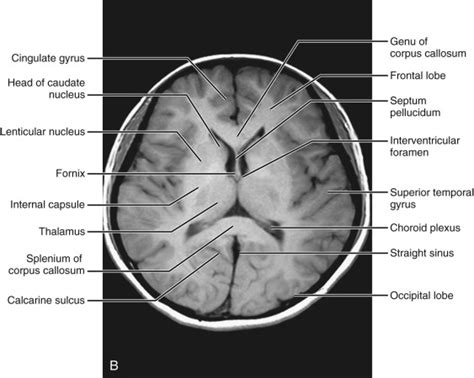 Normal Anatomy | Radiology Key