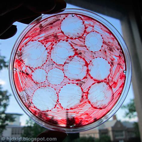 Craftimism: Petri Dish Art