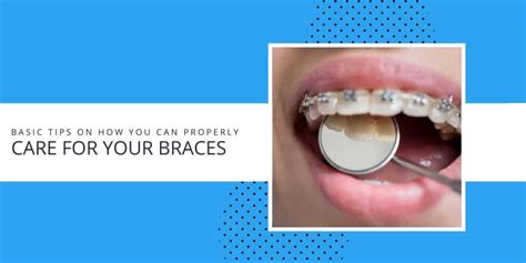 Tips on How You Can Properly Care for Your Braces