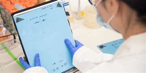 ImprovedExperience - Understanding Western Blot Analysis and Its Importance