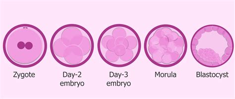 Symptoms After Embryo Transfer - Most Common Positive Signs