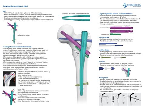 Proximal Femoral Bionic Nail,Medical Device Manufacturers -Double Medical