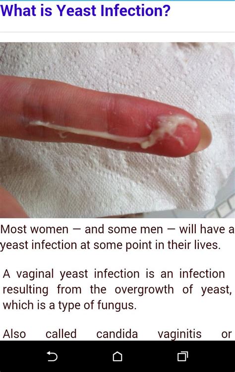 Yeast Infection APK for Android Download