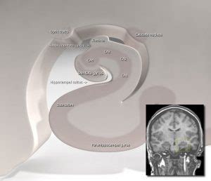 Exploring the Function of the Hippocampus by Anatomy - The Revisionist