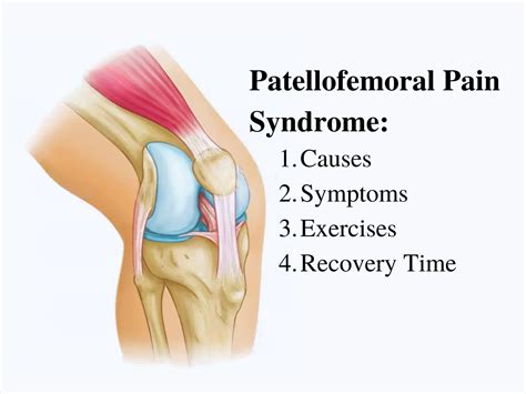 Patellofemoral Pain Syndrome Symptoms, Causes and Exercises