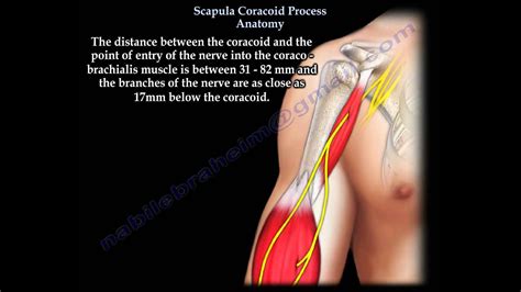 What Attaches To Coracoid Process