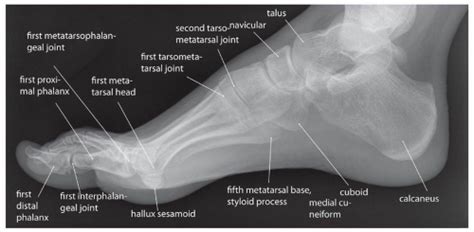 Foot X Ray Anatomy - Anatomy Reading Source