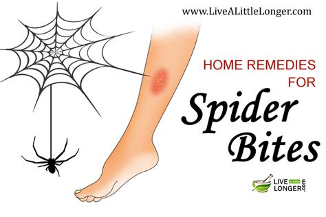 Black Widow Spider Bite Treatment ~ Black Widow Bite Beginning Stages / Spider Bites Symptoms ...