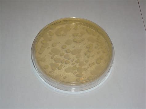 Petri Dish Bacteria Growth Experiment